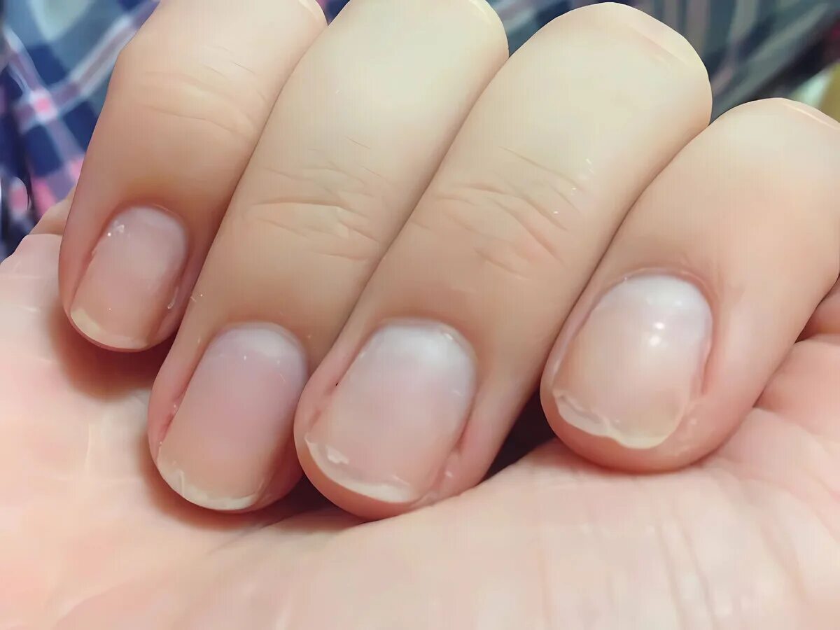 Miksi kynnet haurastuvat ja heikkenevät: Näistä tavoista se johtuu