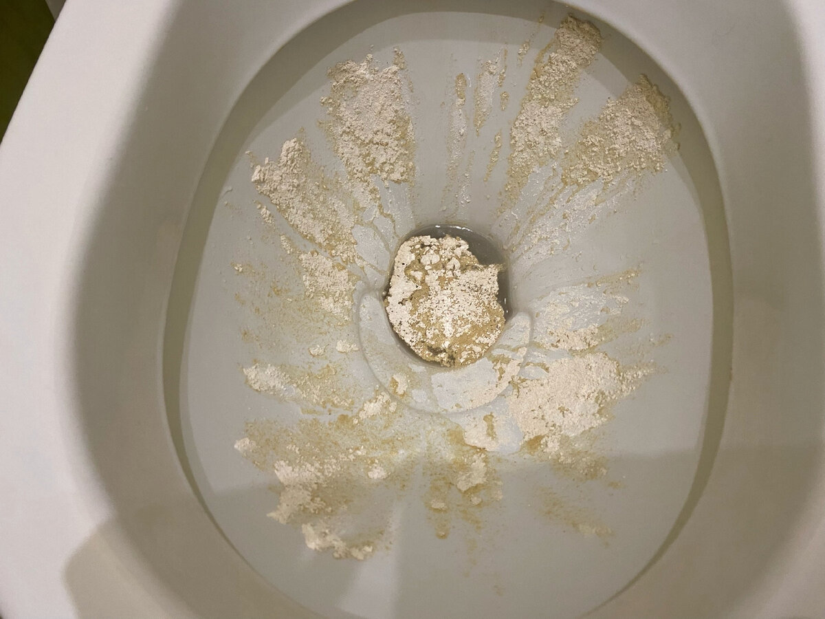 Wc-istuin kiiltää kuin uusi: Wc:n ruosteen ja kalkin poisto